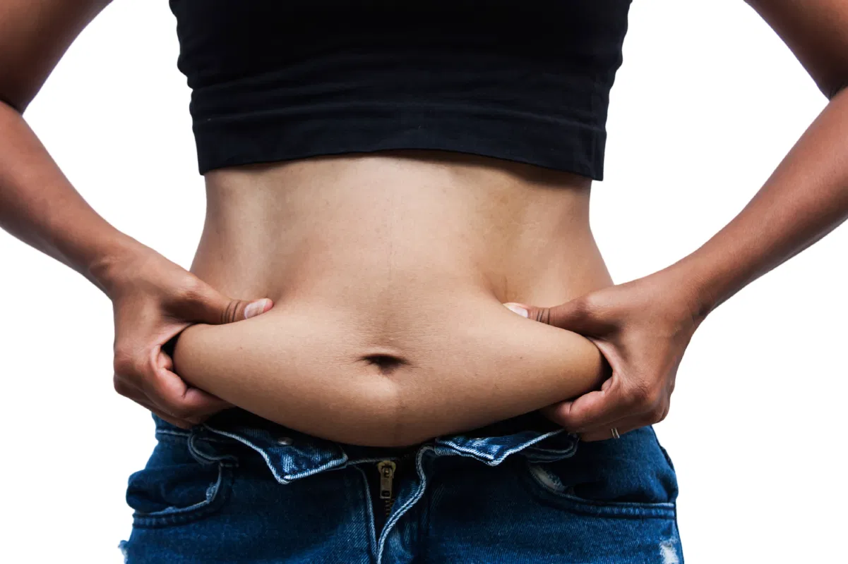 Apron Belly and its Risk Top gycecologists in Noida
